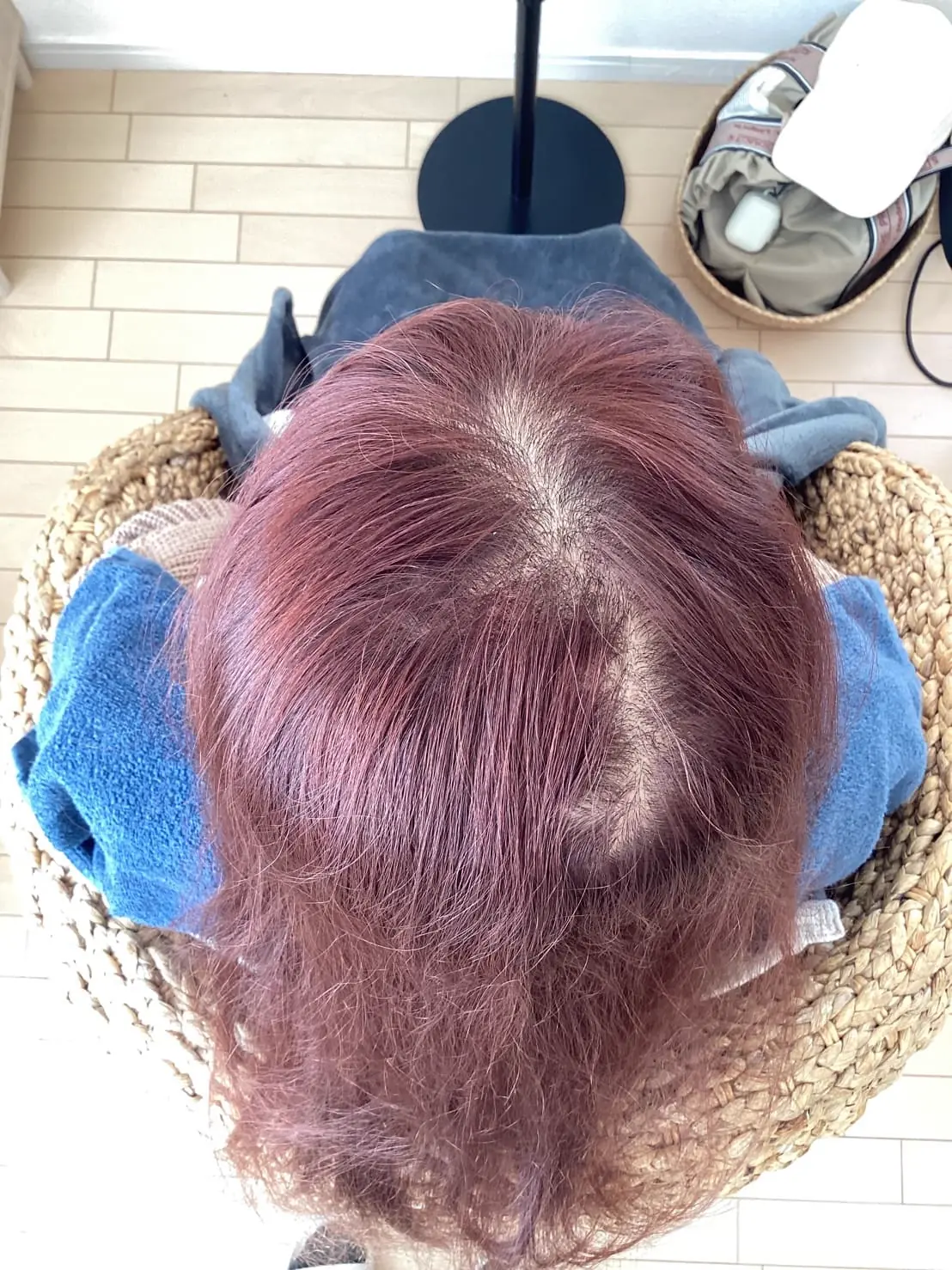 Case1 Before