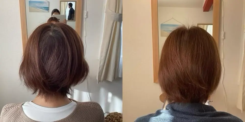 maさんの施術前後の比較